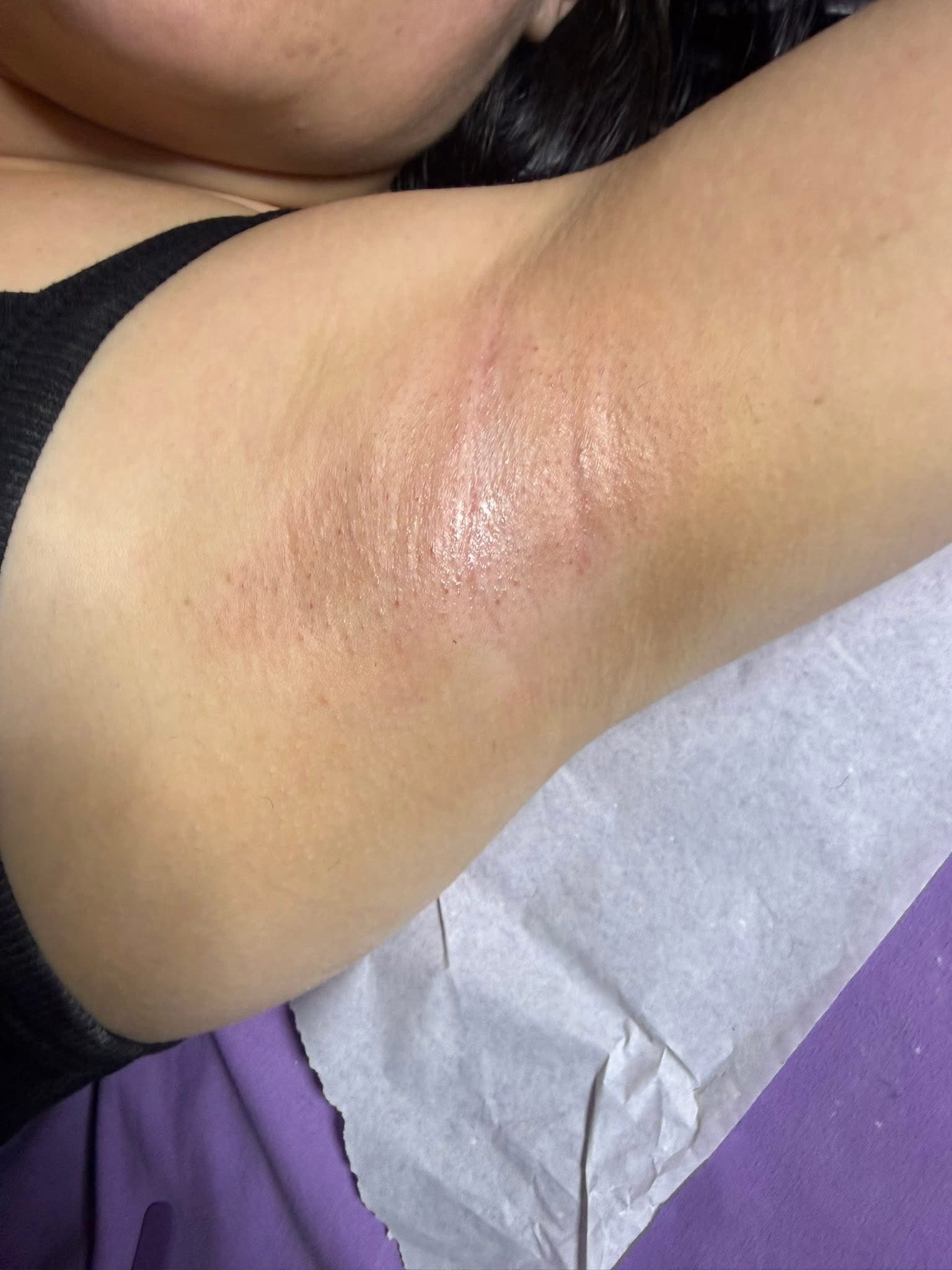 Underarm Waxing